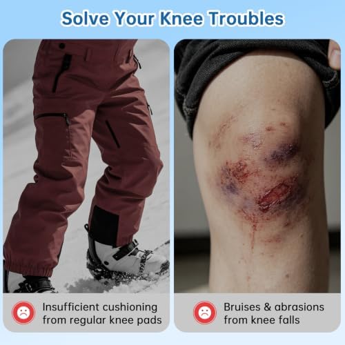Nimiah Silicone Sticky Knee Pads – Shock Absorption Protective Gel Cushions
